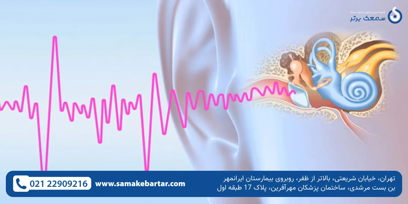 صدای گوش یا همان وزوز گوش چیست؟
