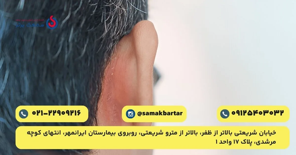 عکس قارچ گوش عفونت قارچی گوش عکس قارچ گوش
