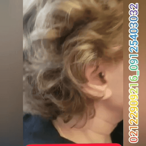 کوچک ترین سمعک ریک